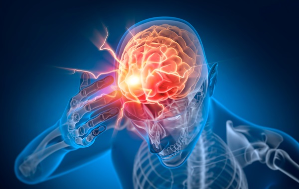 A 3D medical illustration of a transparent blue human figure with a glowing red brain and bright electrical bolts radiating from the forehead to signify a traumatic brain injury after a car accident in Vancouver, Washington.